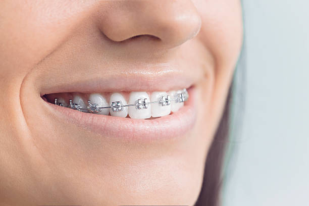 Laser Dentistry in Western Springs, IL